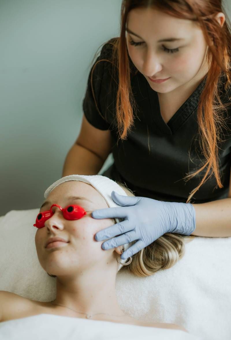 Micro Laser Peel
