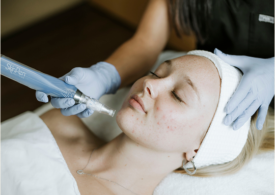 Facial Rejuvenation