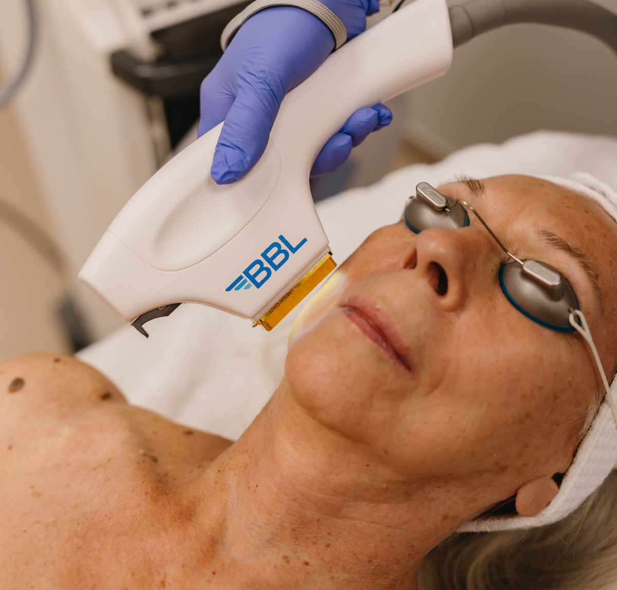 Why the Naples Sun Shows Up on Your Skin