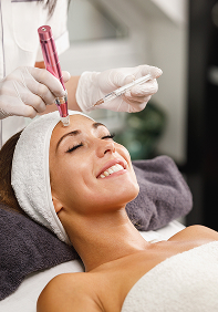 microneedling