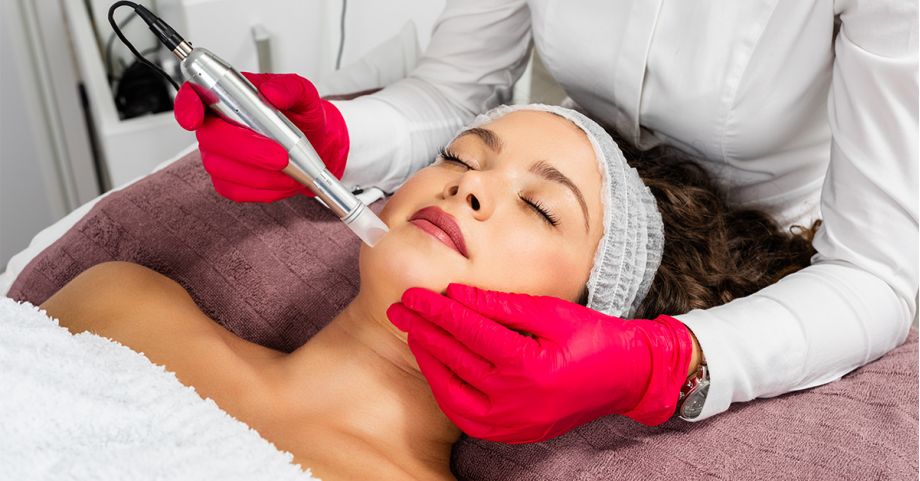 Microneedling