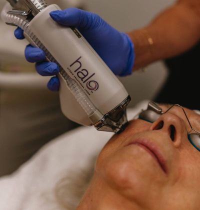 the Halo Laser Matters