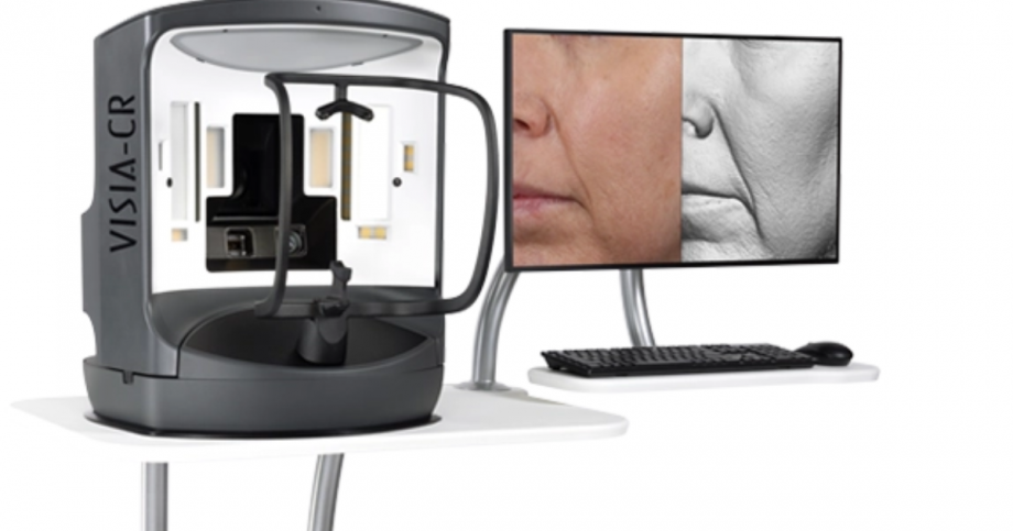 visia skin analysis