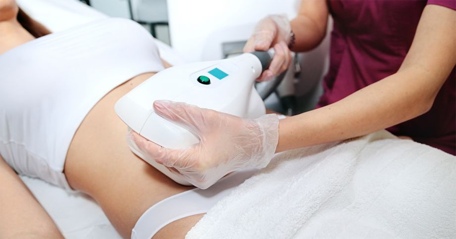 Is CoolSculpting Permanent?