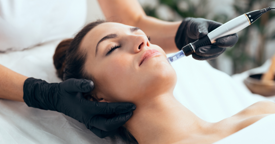 is microneedling worth it